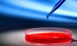 Laboratory pipette with drop of blue liquid over petri dish with red biological analysis solution contaminated by infectious bacteria growth for a biotechnology experiment in a science research lab