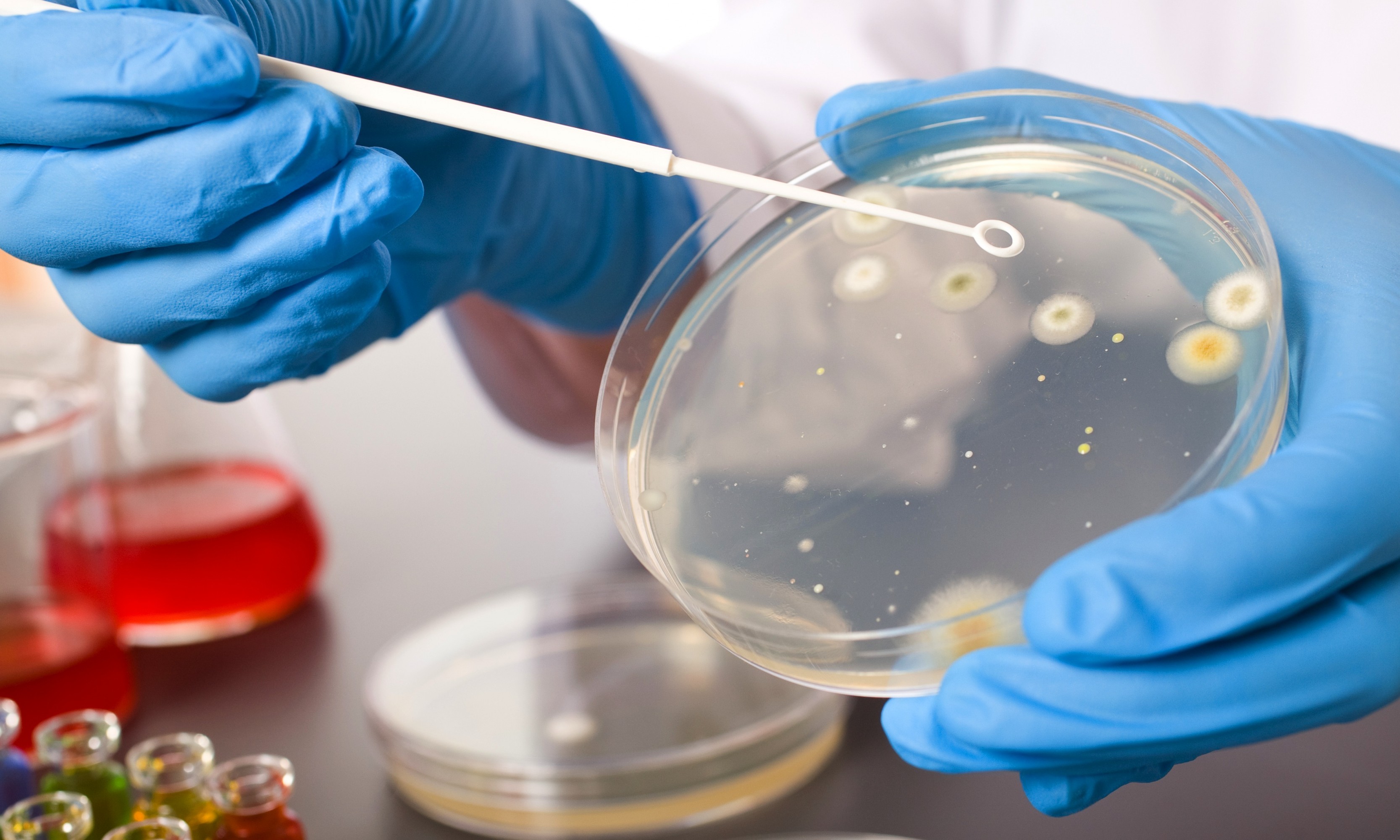Hand in blue glove holds petri dish with agar and bacterium colony