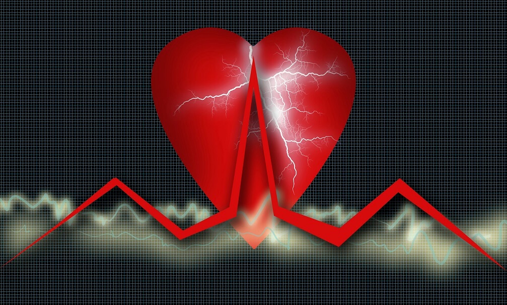 Cardio healthcare: Heart and ekg monitor; grid in background