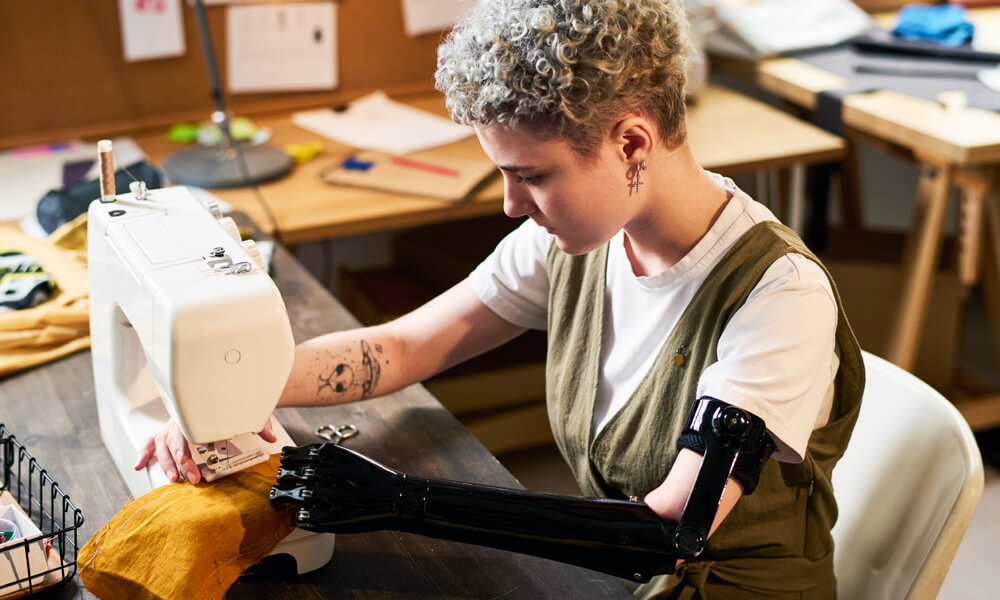 Seamstress with arm prosthesis working on sewing machine